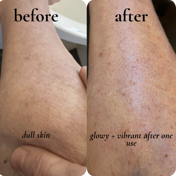dry + aging skin