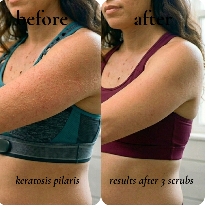 before and after