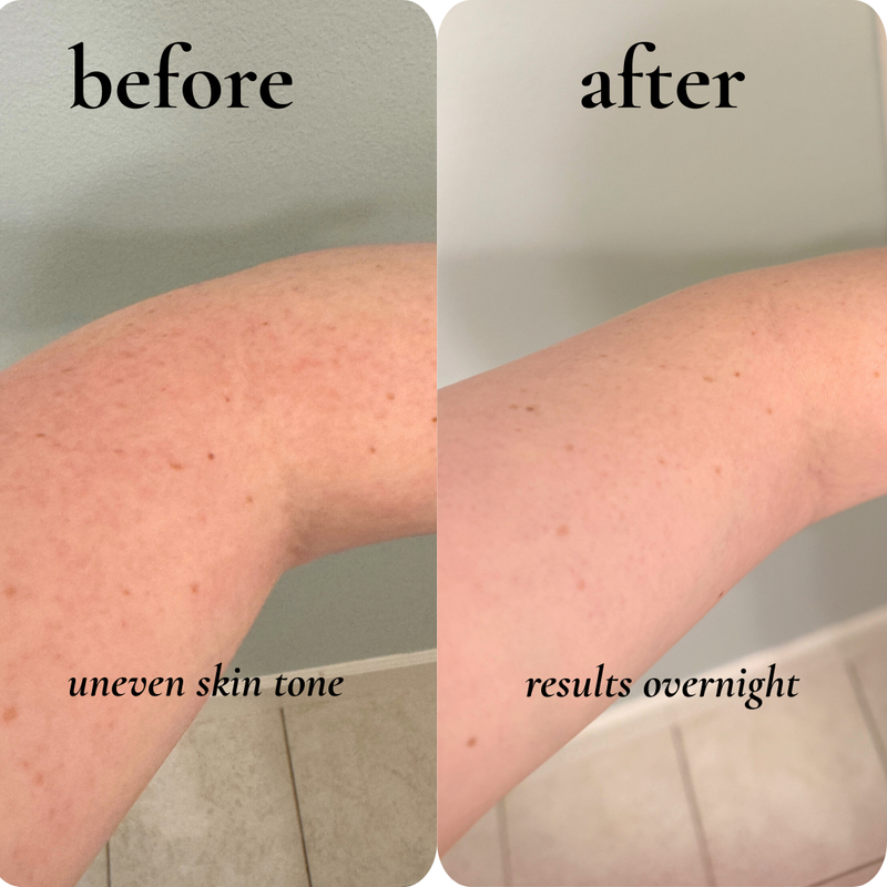 before and after