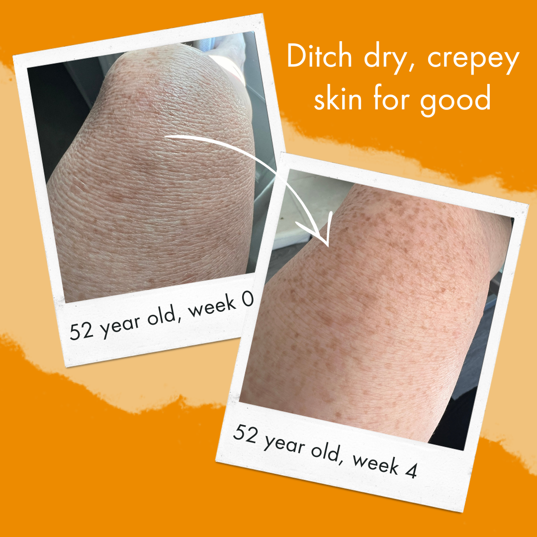 ditch dry, crepey skin