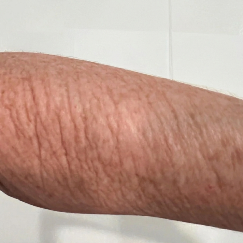 customer skin before starting the essential routine