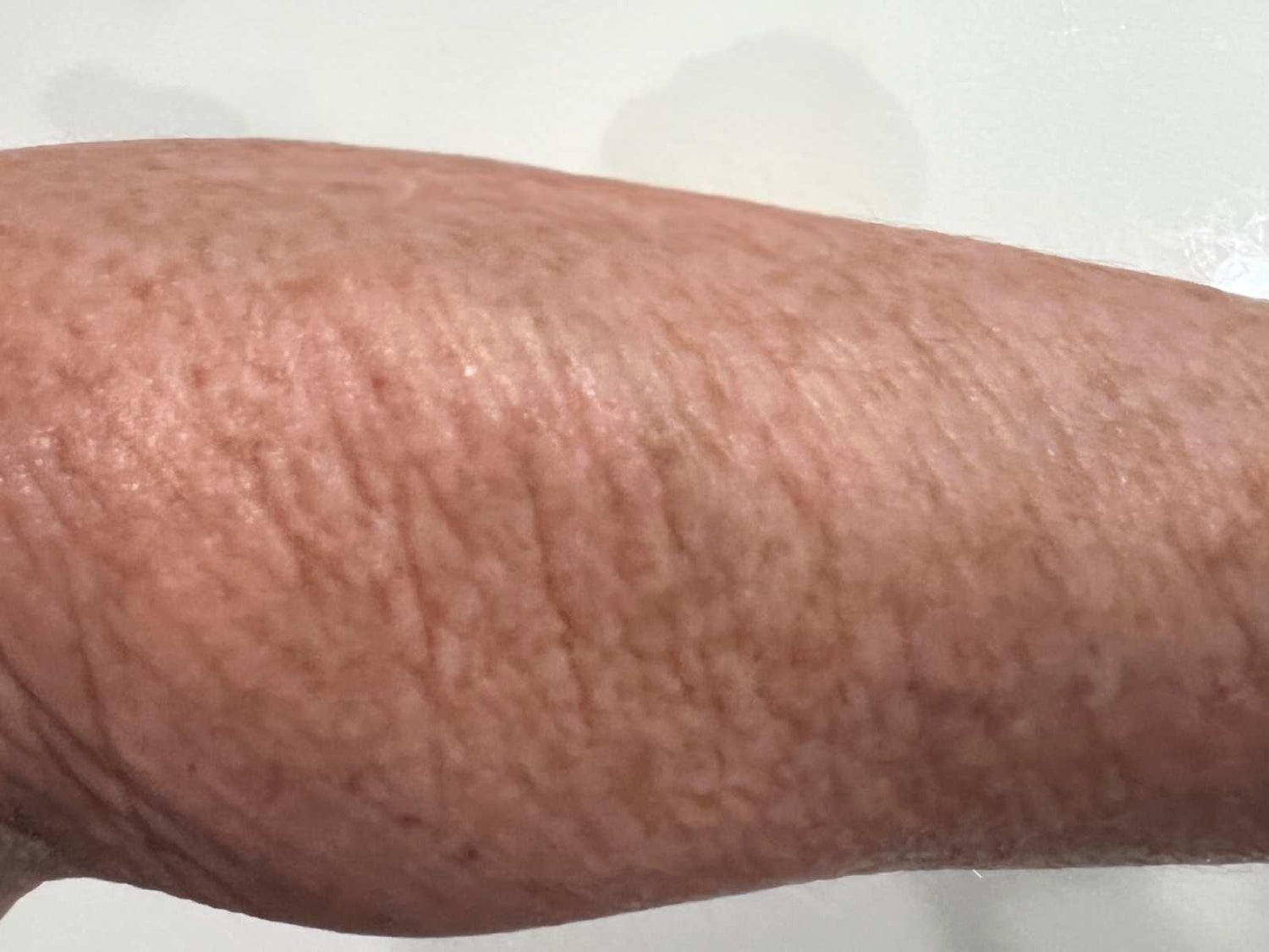 an actual hellomellow customer age 55 crepey arm skin  day 30