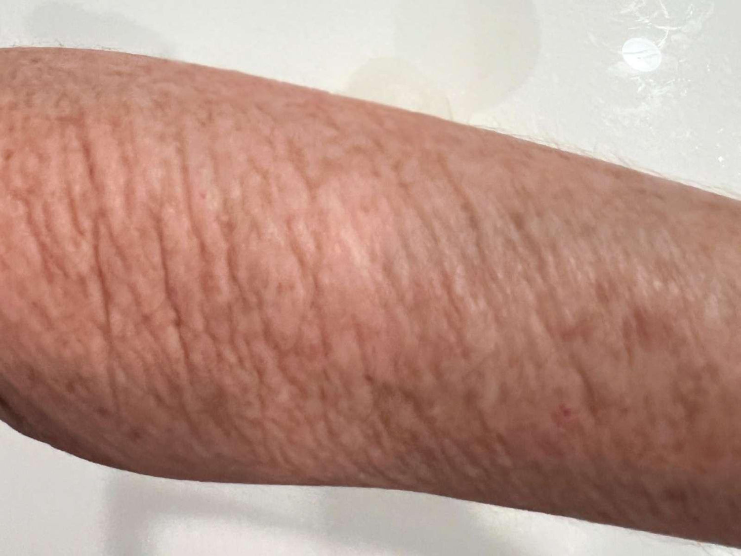 an actual hellomellow customer age 55 crepey arm skin  day 0